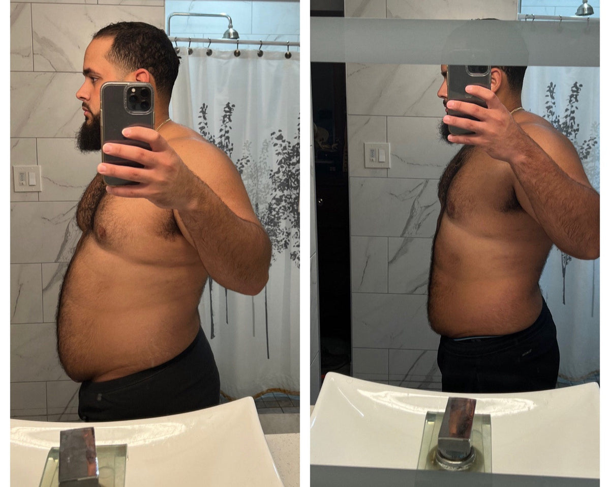Client side-profile before and after photos